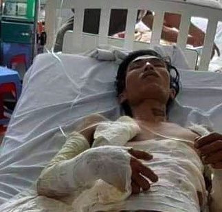Anh Đinh Quốc Biên đang điều trị tại Bệnh viện Chợ Rẫy (ảnh gia đình nạn nhân cung cấp)