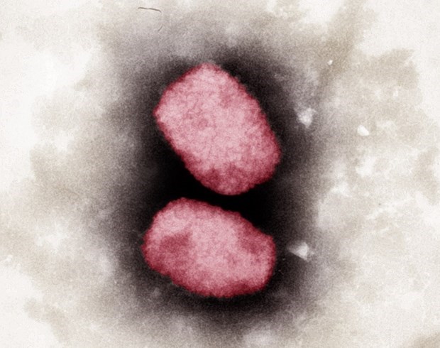 Virus đậu mùa khỉ nhìn dưới kính hiển vi
