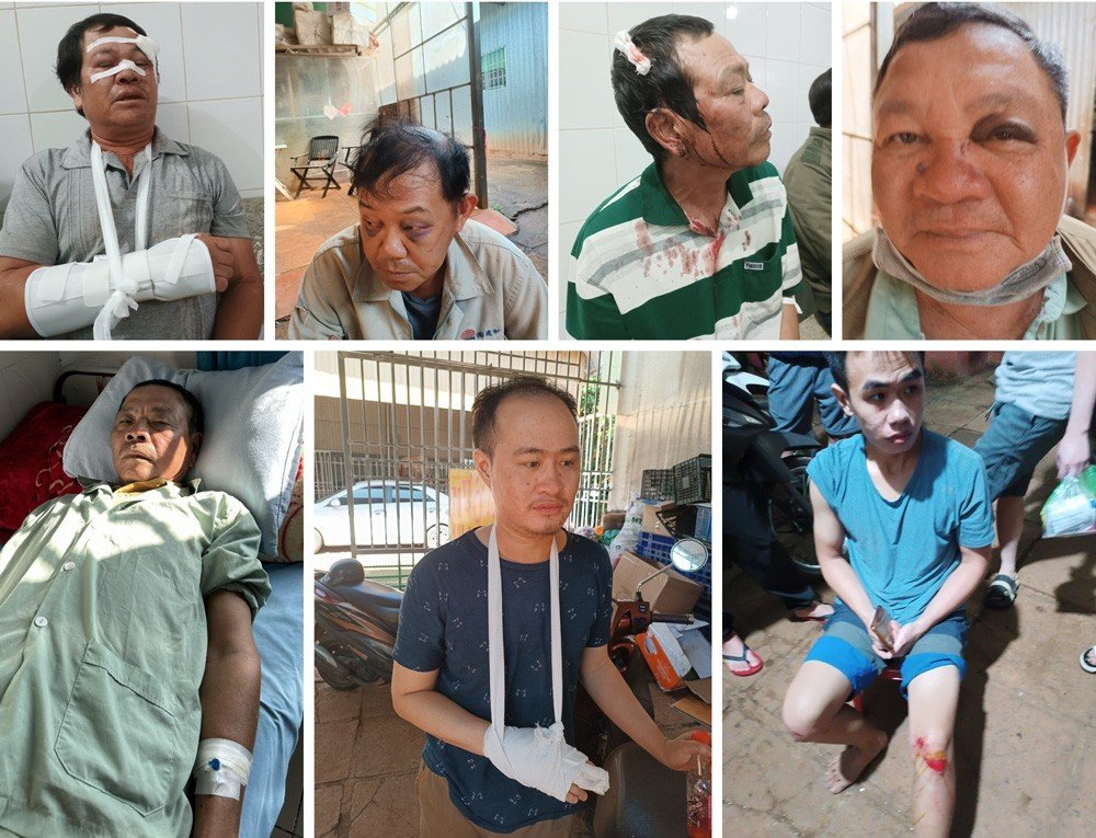 Các thành viên trong gia đình ông Tùng bị hành hung, gây thương tích, có người phải nhập viện điều trị