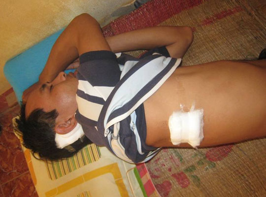Vườn Quốc gia Cát Tiên: Lâm tặc tấn công, một kiểm lâm viên bị thương nặng