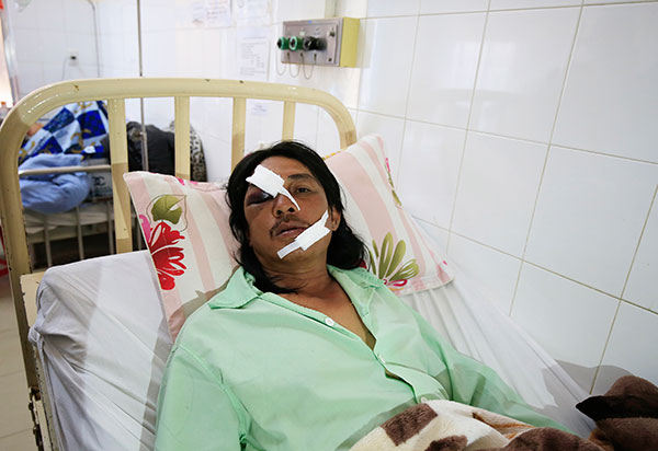 Đà Lạt: Điều tra vụ mang vũ khí vào bệnh viện truy sát bệnh nhân