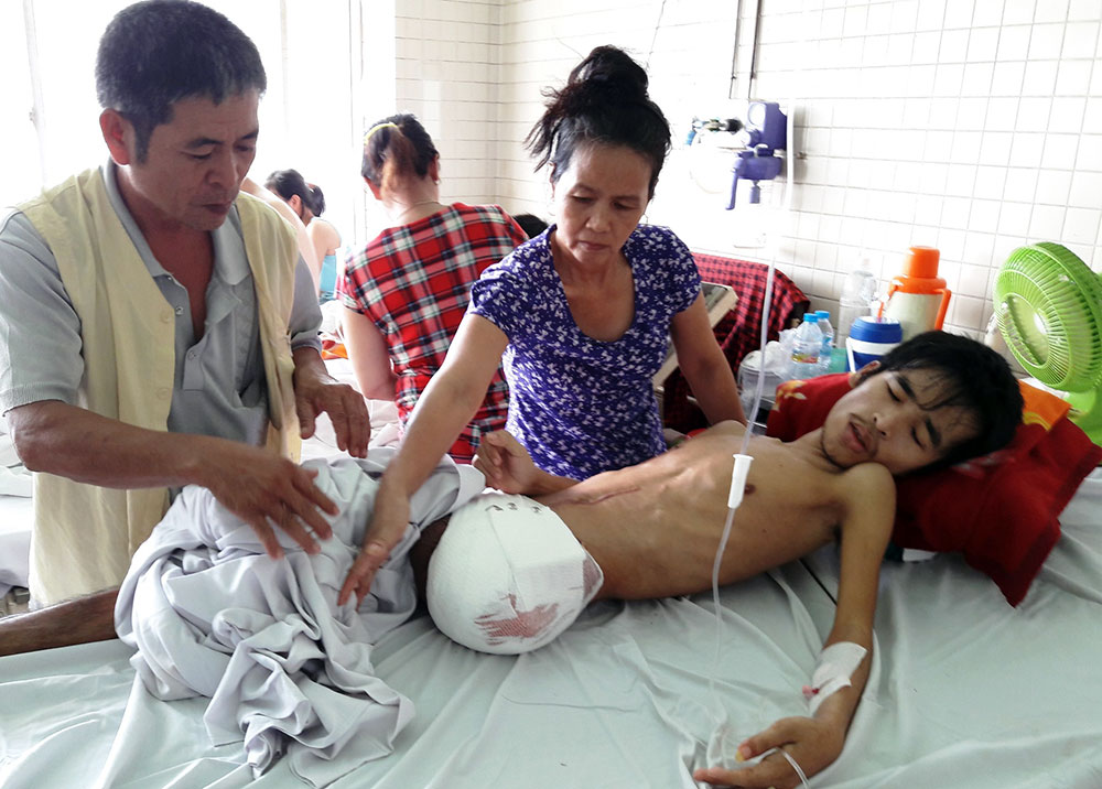Anh Lợi đang điều trị tại Bệnh viện Chợ Rẫy với 1 chân bị cưa do hoại tử