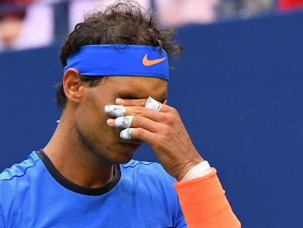 Rafael Nadal thua sốc, vỡ mộng &quot;đại chiến trong mơ&quot; ở US Open