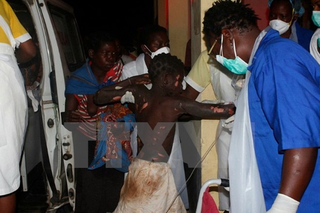 Một nạn nhân bị thương trong vụ nổ xe bồn được điều trị tại bệnh viện ở Tele ngày 17/11. (Nguồn: AFP/TTXVN)