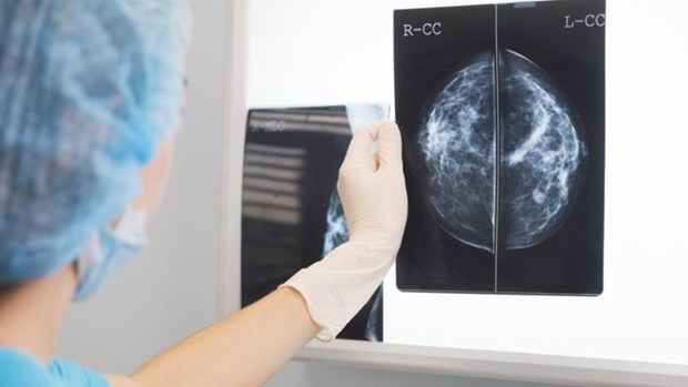 Ứng dụng AI tạo bước ngoặt trong chẩn đoán ung thư vú