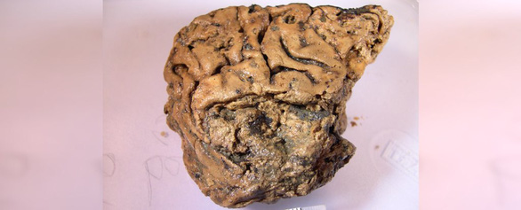 Kinh ngạc mô não người vẫn 'còn nguyên' sau 2.600 năm