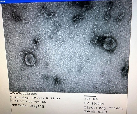 Ngày 7/2/2020, Viện Vệ sinh dịch tễ Trung ương công bố đã nuôi cấy và phân lập thành công chủng virus corona mới (COVID-19) 