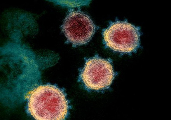 Hình ảnh virus corona chủng mới phân lập từ một bệnh nhân ở Mỹ