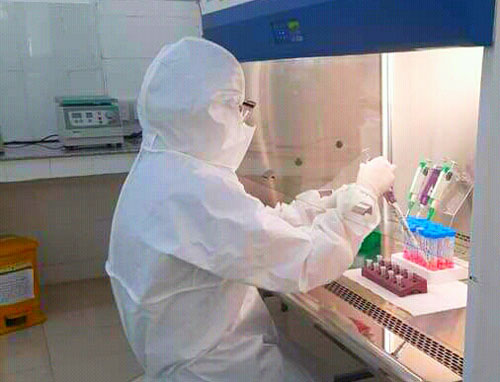 Xét nghiệm SARS-CoV-2 bằng phương pháp RT-PCR tại CDC tỉnh