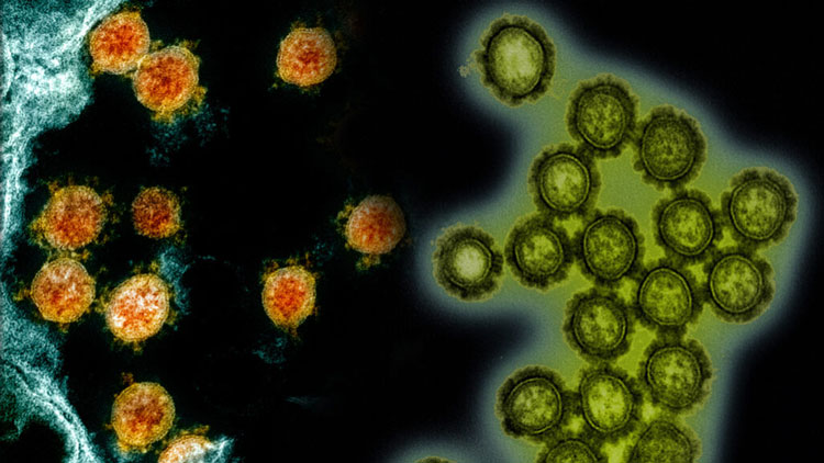 SARS-CoV-2, vi rút gây ra COVID-19 (được hiển thị trong hình ảnh hiển vi điện tử, bên trái, màu cam) có thể sớm đối mặt với bệnh cúm (các phần tử vi rút cúm H1N1 bên phải, màu xanh lục), các nhà khoa học vẫn chưa biết cuộc chạm trán này sẽ kết thúc như thế nào. Ảnh: Science News 