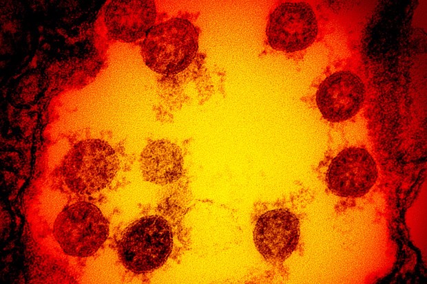 Nghiên cứu mới về thời gian virus SARS-CoV-2 tồn tại trên da người