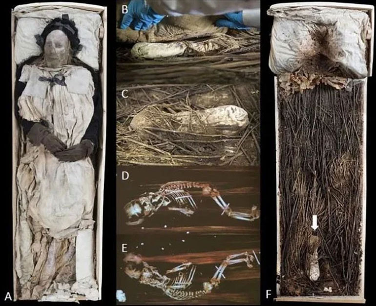 Giải mã xác ướp giám mục được chôn cùng một bào thai cách đây 350 năm