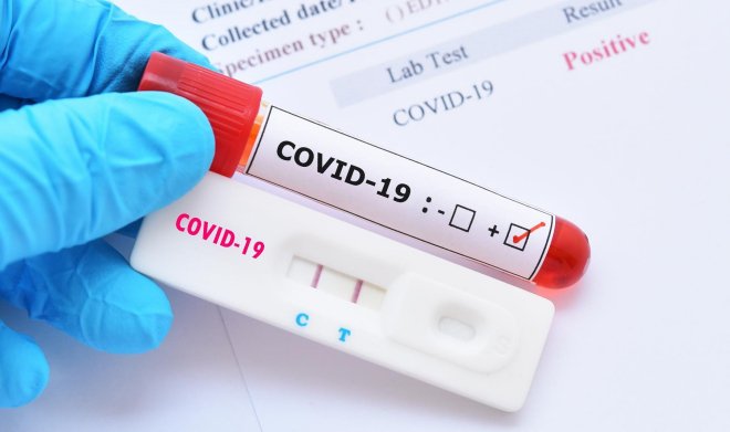 Bộ Y tế: Người chưa tiêm đủ liều vaccine COVID-19 ở vùng dịch về phải cách ly 14 ngày, xét nghiệm 3 lần