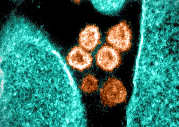 Hình ảnh virus SARS-CoV-2 chụp qua kính hiển vi điện tử tại phòng thí nghiệm ở Hamilton, Montana (Mỹ), ngày 28/6/2021