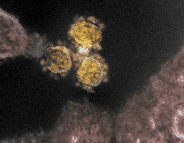 Hình ảnh quét qua kính hiển vi điện tử cho thấy virus SARS-COV-2 trên một mẫu bệnh phẩm của bệnh nhân COVID-19