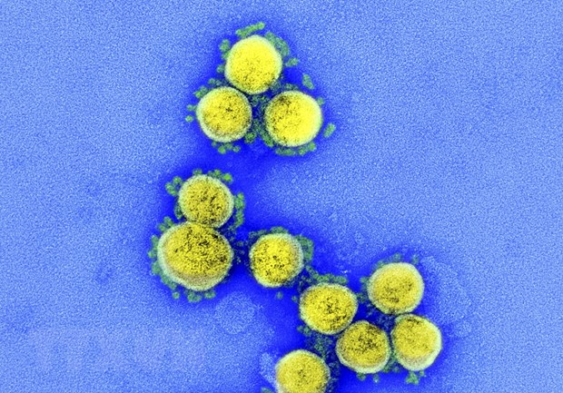 Hình ảnh từ kính hiển vi do Viện Y tế quốc gia Mỹ cung cấp cho thấy virus SARS-CoV-2 trong mẫu bệnh phẩm của bệnh nhân mắc COVID-19 ở Mỹ. 