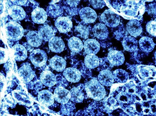 Hình ảnh từ kính hiển vi do Viện nghiên cứu bệnh truyền nhiễm và dị ứng quốc gia Mỹ cung cấp cho thấy các phần tử virus SARS-CoV-2 trong mẫu bệnh phẩm của bệnh nhân mắc COVID-19.