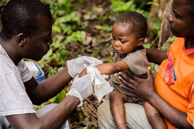 Nhân viên y tế điều trị cho một em nhỏ mắc bệnh đậu mùa khỉ tại Zomea Kaka (Cộng hòa Trung Phi), ngày 18/10/2018