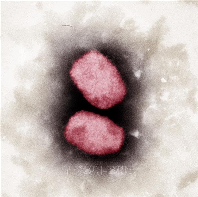 Virus đậu mùa khỉ nhìn dưới kính hiển vi tại Viện nghiên cứu Robert Koch của chính quyền liên bang Đức, ngày 23/5/2022