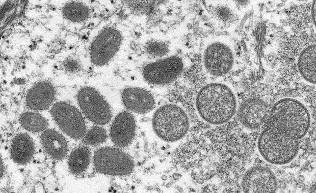 Hình ảnh virus đậu mùa khỉ dưới kính hiển vi điện tử