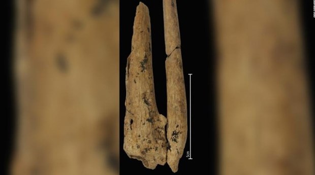 Phần xương bị cắt rất "sạch" cho thấy người cổ đại ở Indonesia đã trải qua một cuộc phẫu thuật cắt chi