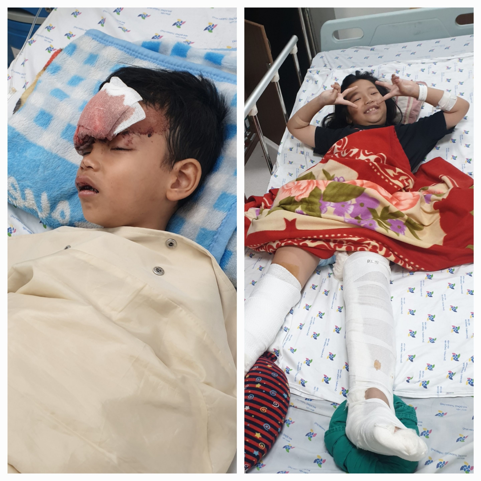 Hai người con nhỏ của gia đình chị Linh đang điều trị tại Bệnh viện Nhi Đồng