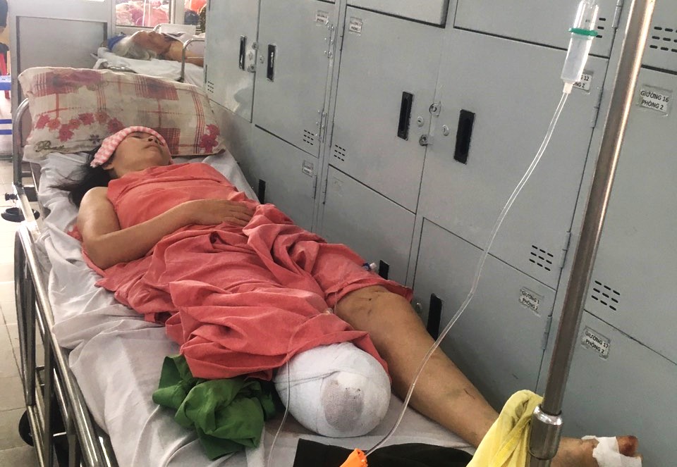 Cô giáo Trần Thị Trí bị cưa chân sau tai nạn giao thông, hiện đang điều trị tại Bệnh viện Chợ Rẫy