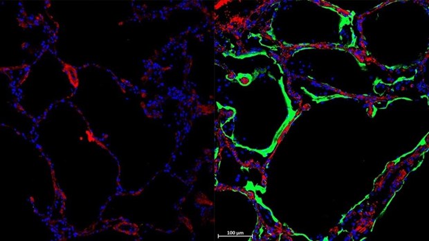 Phát hiện ra loại protein mới có thể ngăn chặn virus SARS-CoV-2