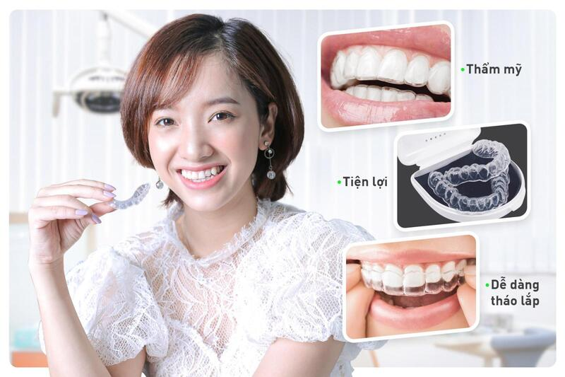 Tìm hiểu niềng răng trong suốt Invisalign: Lợi ích và đặc điểm nổi bật