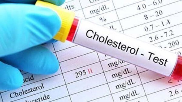 Những người có mức cholesterol HDL cao (thấp nhất là 65 mg/dL) có nguy cơ mắc chứng lẫn cao hơn 15% so với người khác