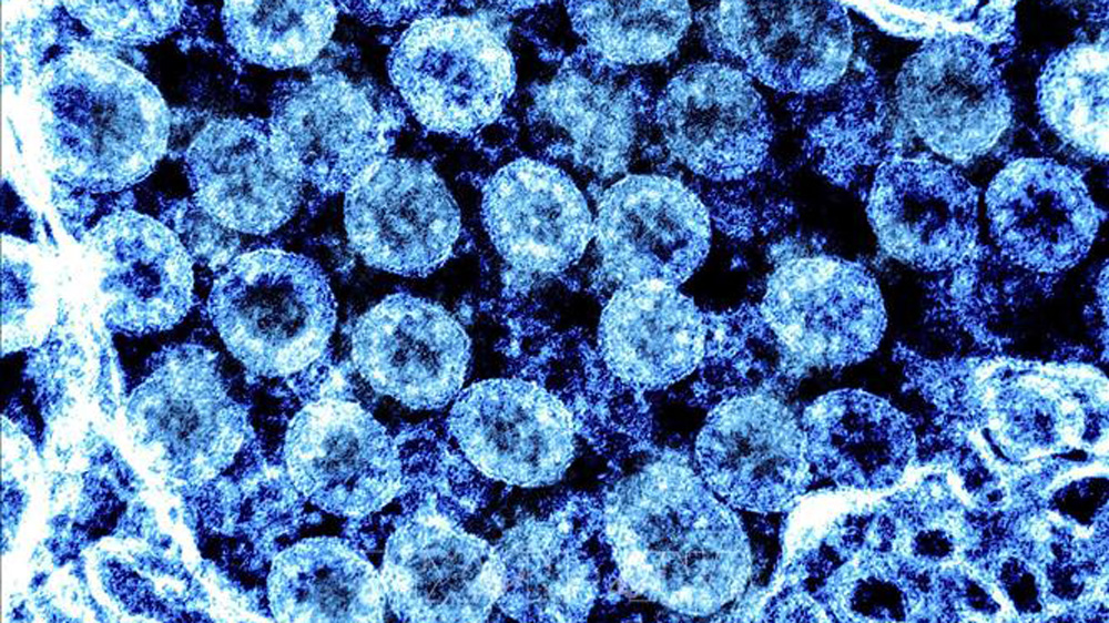 Hình ảnh từ kính hiển vi do Viện nghiên cứu bệnh truyền nhiễm và dị ứng quốc gia Mỹ cung cấp cho thấy virus SARS-CoV-2 trong mẫu bệnh phẩm của bệnh nhân mắc COVID-19