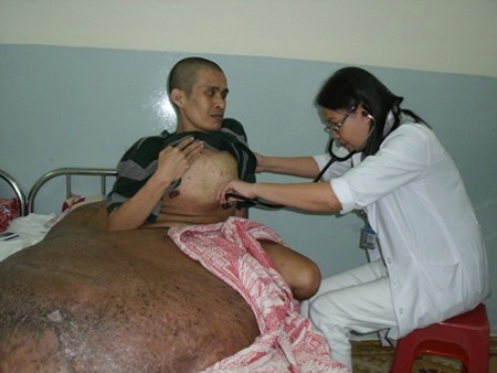 Bác sĩ đang thăm khám khối u cho bệnh nhân Nguyễn Duy Hải tại BV Ung bướu TPHCM. Ảnh: V.T