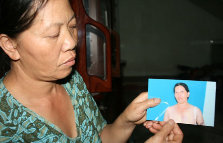 Bảo Lâm: Một công an xã bị tố cáo đánh dân