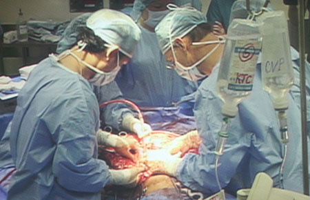 Các bác sĩ đang phẫu thuật cắt bỏ khối u 90k. Ảnh Nguyên Mi
