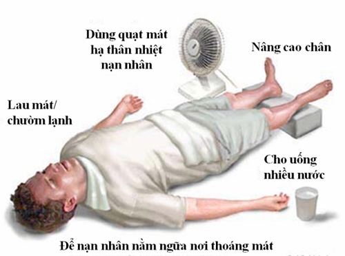 Các biện pháp cần thực hiện để sơ cứu người say nắng, say nóng