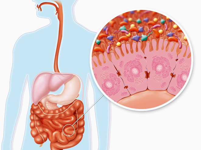 5 lời khuyên vàng cho hệ tiêu hóa khỏe mạnh